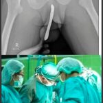 Doctors are speechless: Just boil these 2 ingredients and you will quickly lose your body fat !